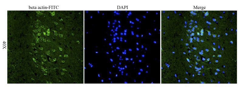 beta Actin antibody (FITC)