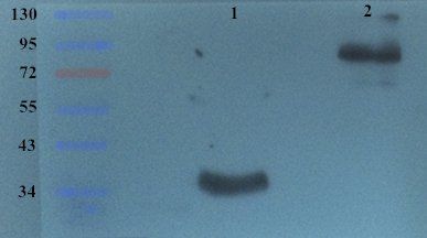 CD105 antibody