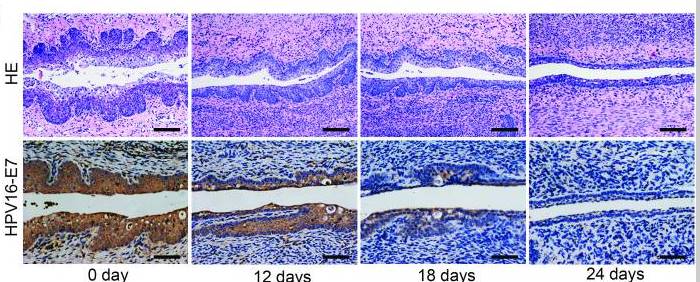 HPV16 E7 antibody