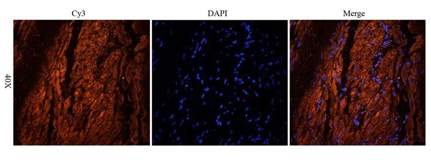 Mlkl antibody