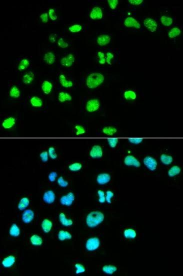 MSH6 antibody