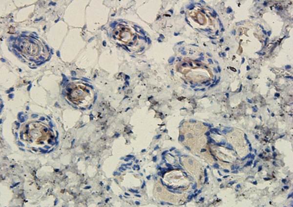 Islet 1 antibody