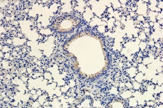 Islet 1 antibody