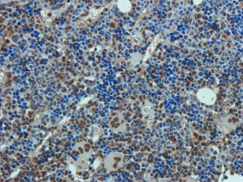 Osteocalcin antibody