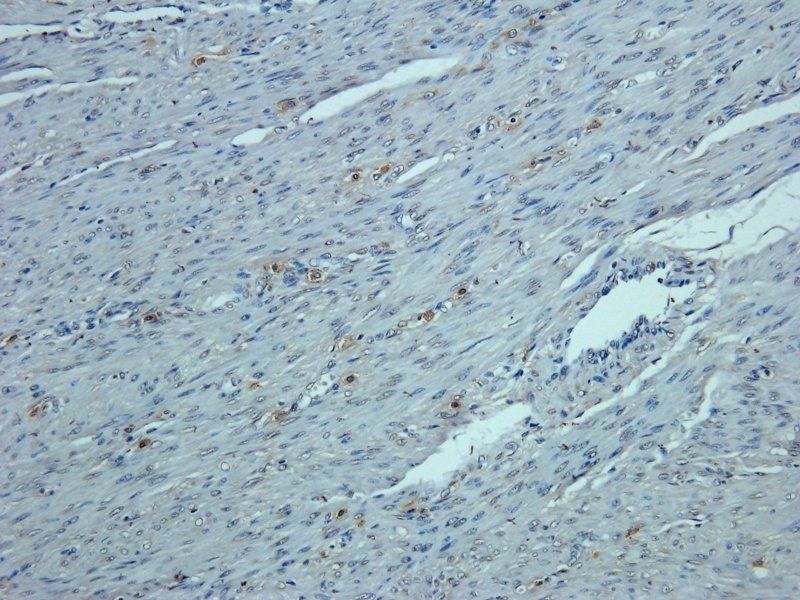 Osteocalcin antibody