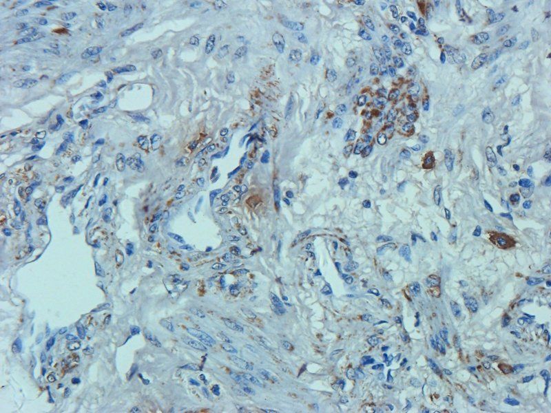 Osteocalcin antibody