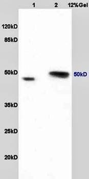 Ribonuclease Inhibitor antibody