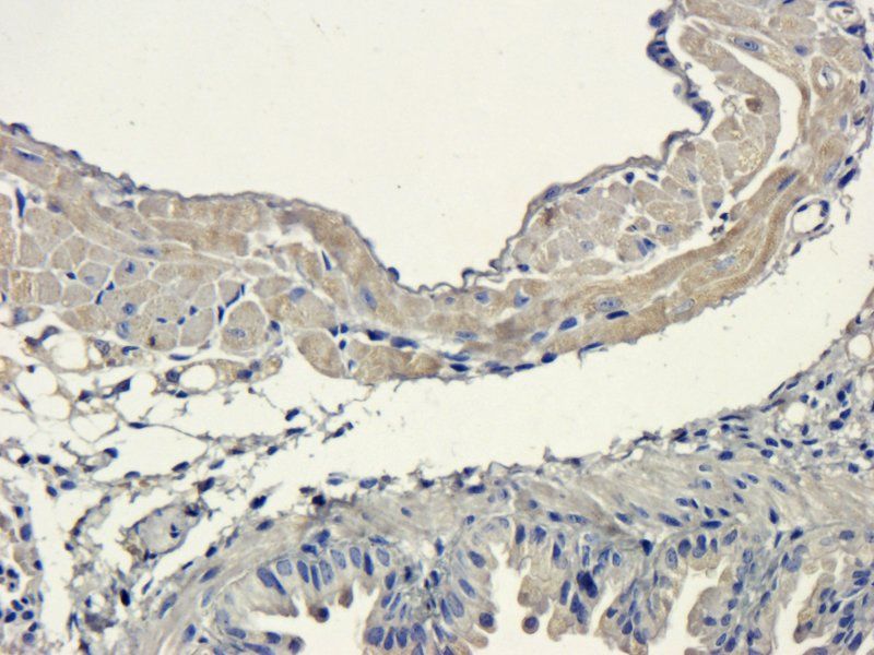 Sclerostin antibody