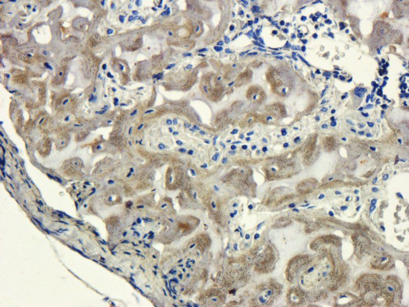 Sclerostin antibody