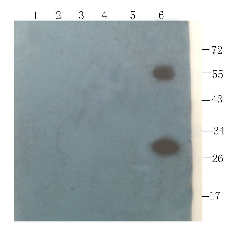 Sclerostin antibody