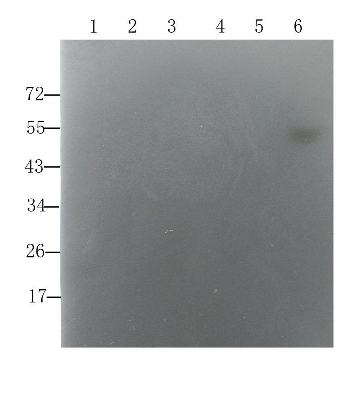 Sclerostin antibody