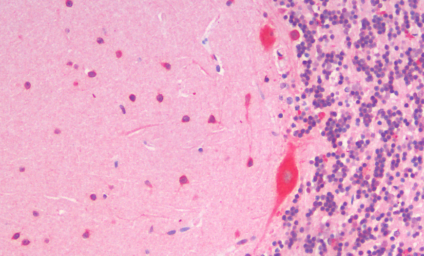 SLC7A6 antibody