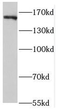 ROCK2 antibody