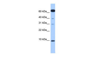 DYNLL2 Antibody