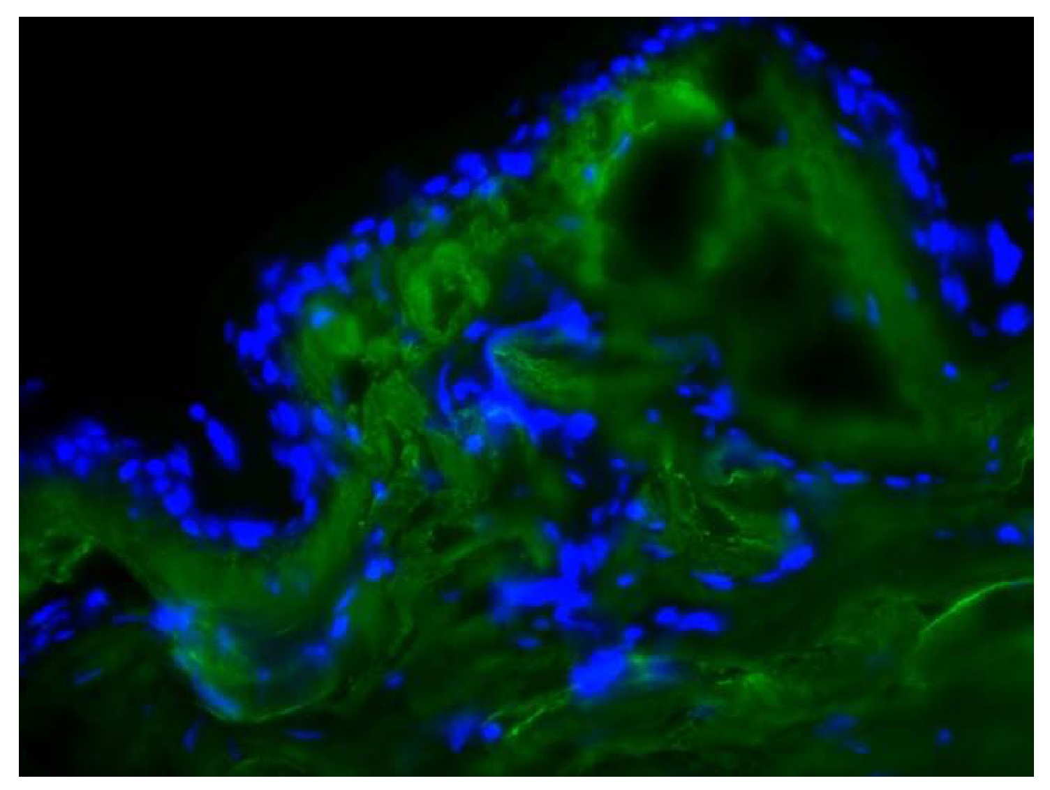 Type I Collagen Antibody (FITC)