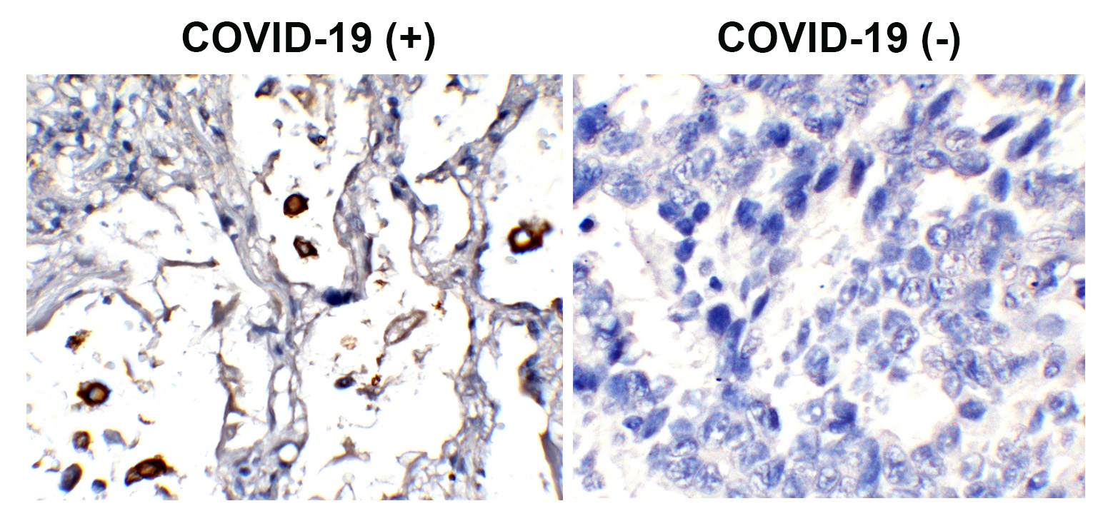 SARS-CoV-2 (COVID-19) Nucleocapsid Antibody (HRP)