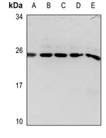 Glucagon antibody