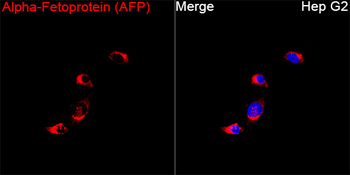 Alpha 1 Fetoprotein antibody