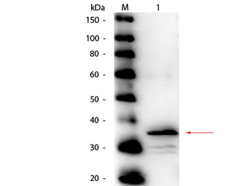 Carboxypeptidase B antibody (Peroxidase)