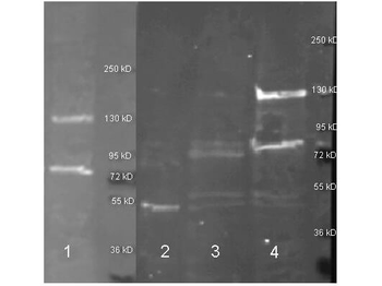 Adenosine Deaminase antibody (Peroxidase)