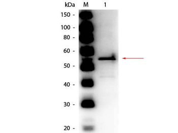 Aldehyde Dehydrogenase antibody (Peroxidase)