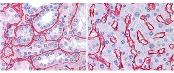 Collagen IV antibody (Peroxidase)