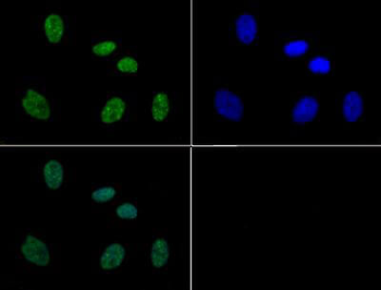 Histone H3 pS10/pT11 antibody