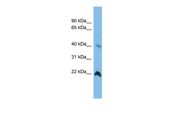 TGDS antibody