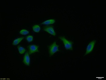 Beta Tubulin(Loading Control) antibody