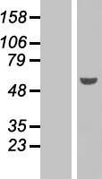 PAX6 Human Over-expression Lysate