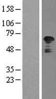 TRK fused gene (TFG) Human Over-expression Lysate