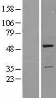 TRK fused gene (TFG) Human Over-expression Lysate