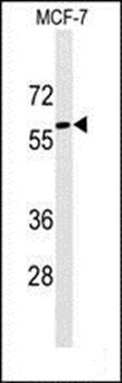 Alpha 1 Fetoprotein antibody