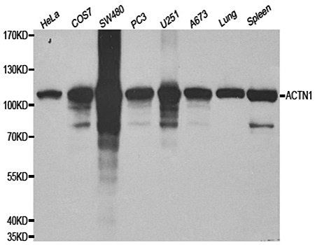 ACTN1 antibody