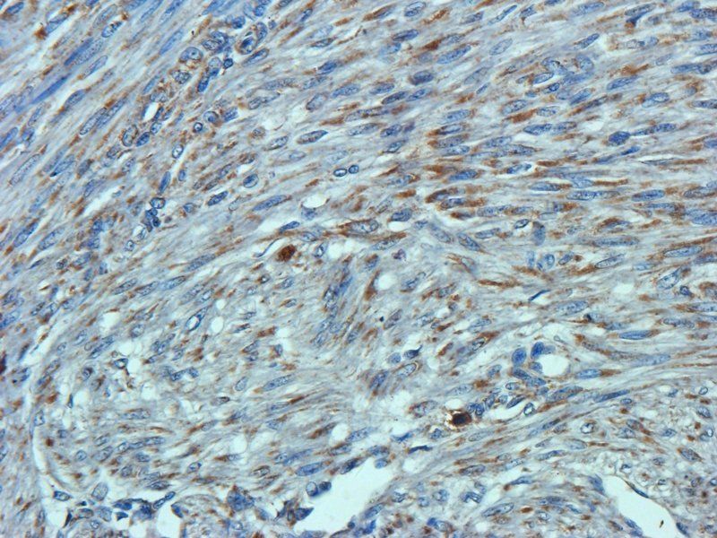 Osteocalcin antibody