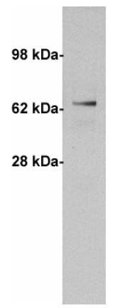 Alpha 1 Fetoprotein antibody