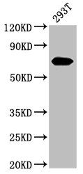 Alpha 1 Fetoprotein antibody