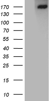 Angiotensin Converting Enzyme 1 (ACE) antibody