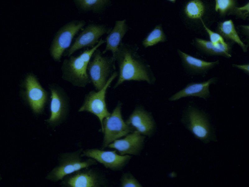 beta Actin antibody (FITC)