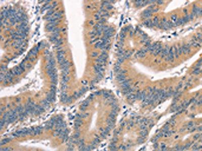 CRIM1 antibody