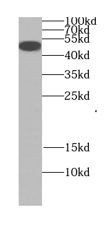 Ephrin B1 antibody