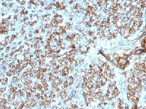 HLA-DR antibody