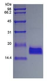 Human EMAP II protein