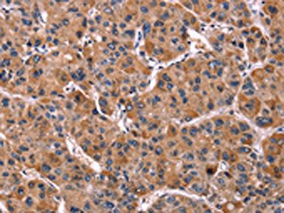 LILRB1 antibody