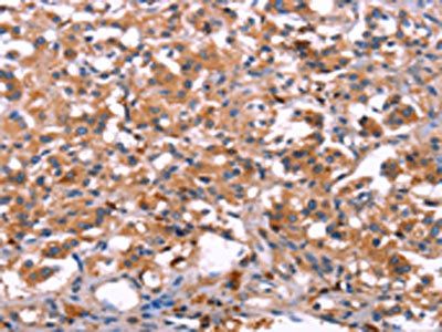 LILRB1 antibody