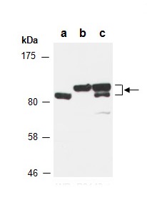 RHBDF2 antibody