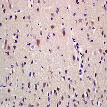 Ribonuclease Inhibitor antibody