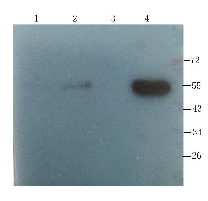 Sclerostin antibody