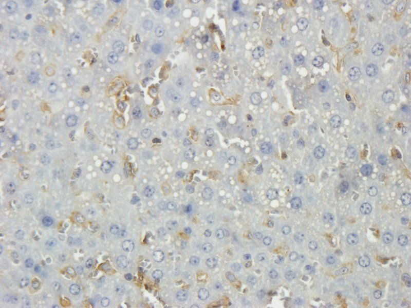 Thrombospondin 2 antibody