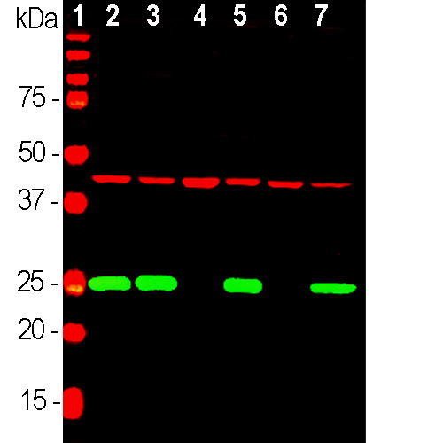 Western Blot